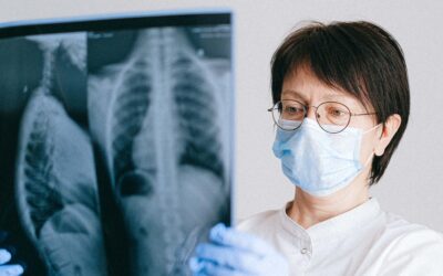 What Does Medicare Plan F Cover?