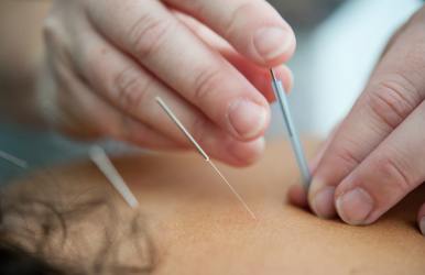 Does Medicare Cover Acupuncture?